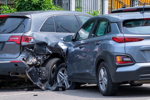 Gardena Traumatic Brain Injury Law Firms thumbnail